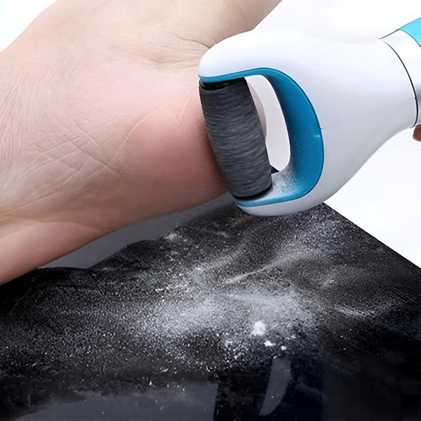 Rechargeable Callus Remover with Rotating Abrasive Head and Detachable Design