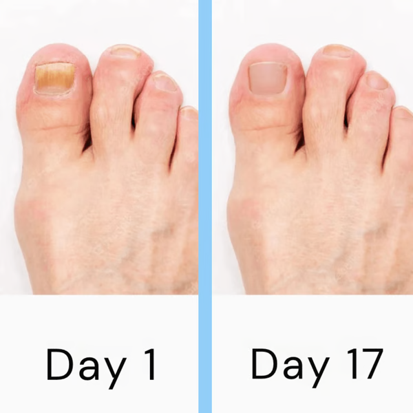 LED Nail Treatment Device with Dual Wavelength Technology and Automatic Activation