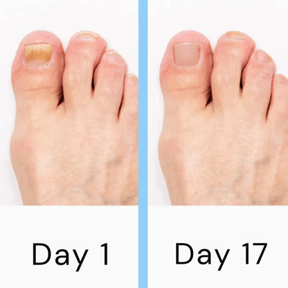 LED Nail Treatment Device with Dual Wavelength Technology and Automatic Activation