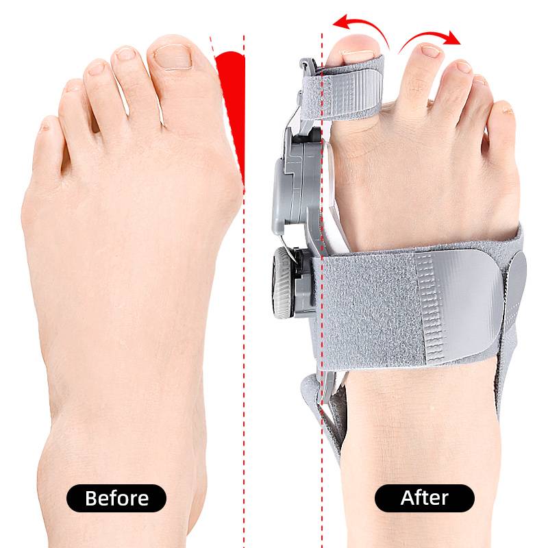Bunion Corrector with Hinge Joint and Adjustable Knob for Universal Foot Sizes