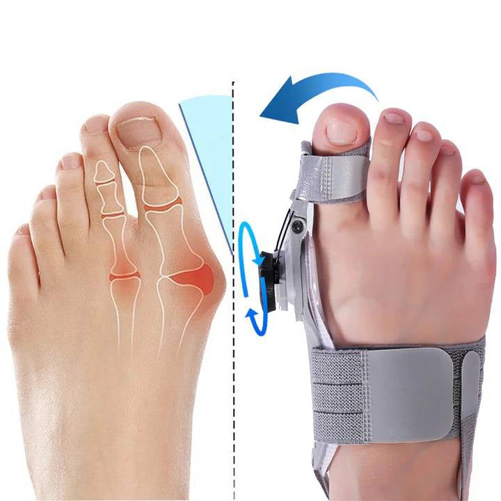 Bunion Corrector with Hinge Joint and Adjustable Knob for Universal Foot Sizes