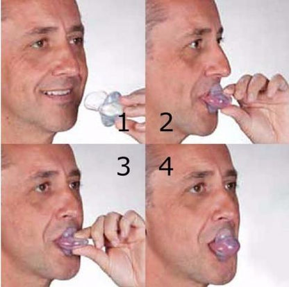 Tongue Stabilizing Device with Suction Bulb for Quiet Sleep and Denture Wearers